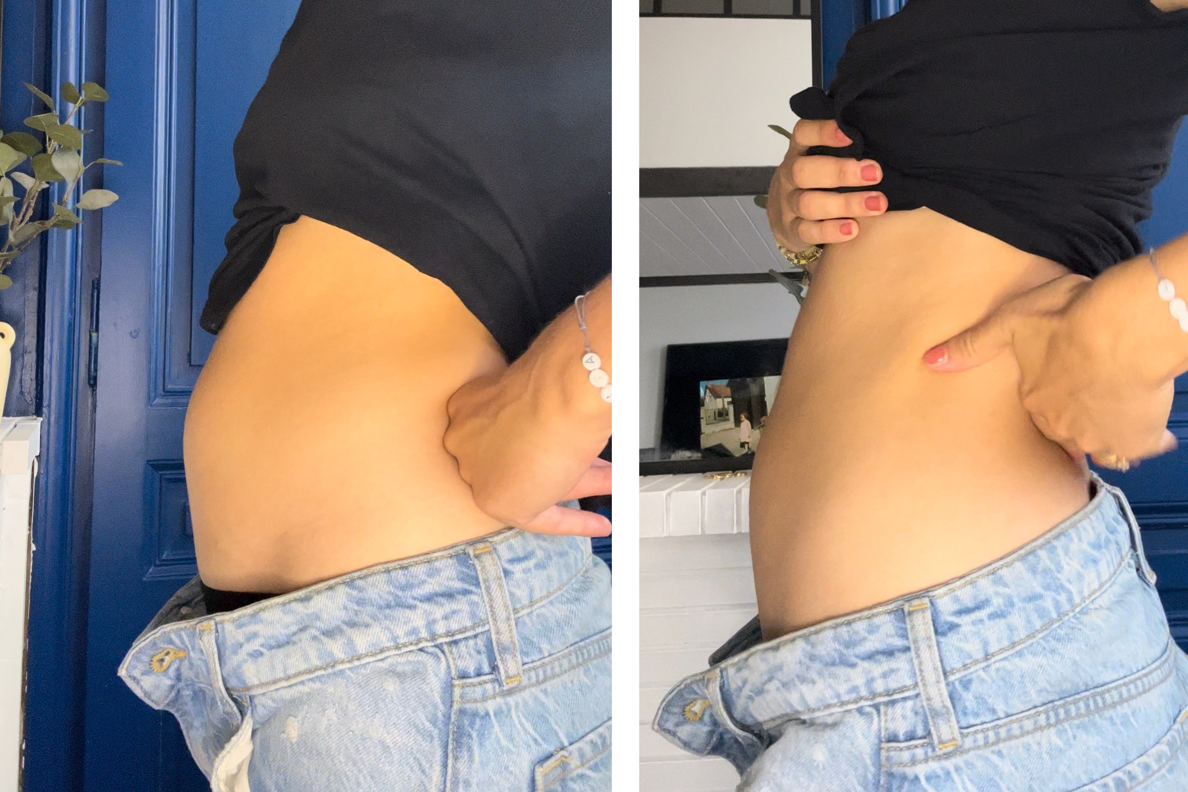 endométriose endobelly baume massage